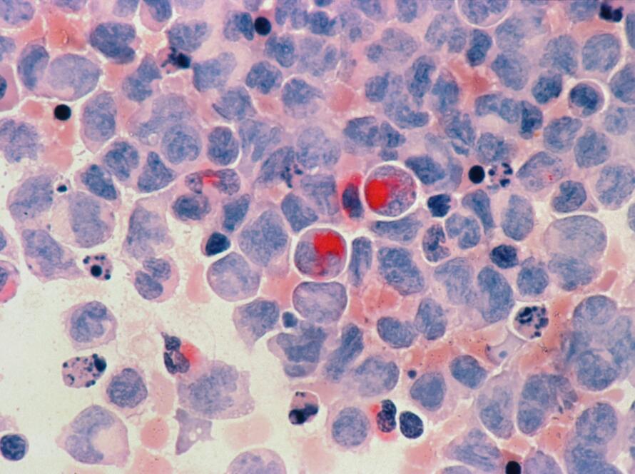 red round fruits on white and blue surface
